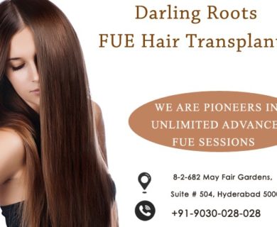 Hair Transplant Archives | Hair Transplant Archives |