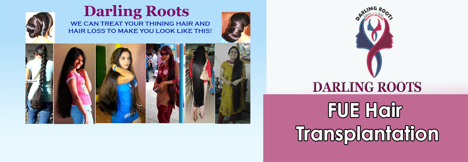 Best FUE Hair Transplant Clinic in Hyderabad | Darling Roots Best FUE Hair Transplant Clinic in Hyderabad | Darling Roots